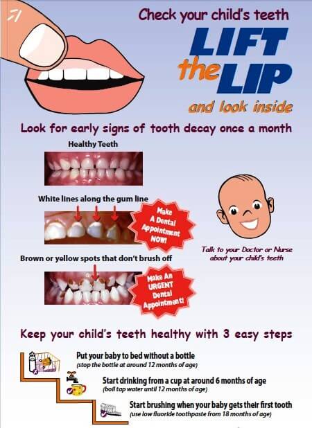Check your child's teeth